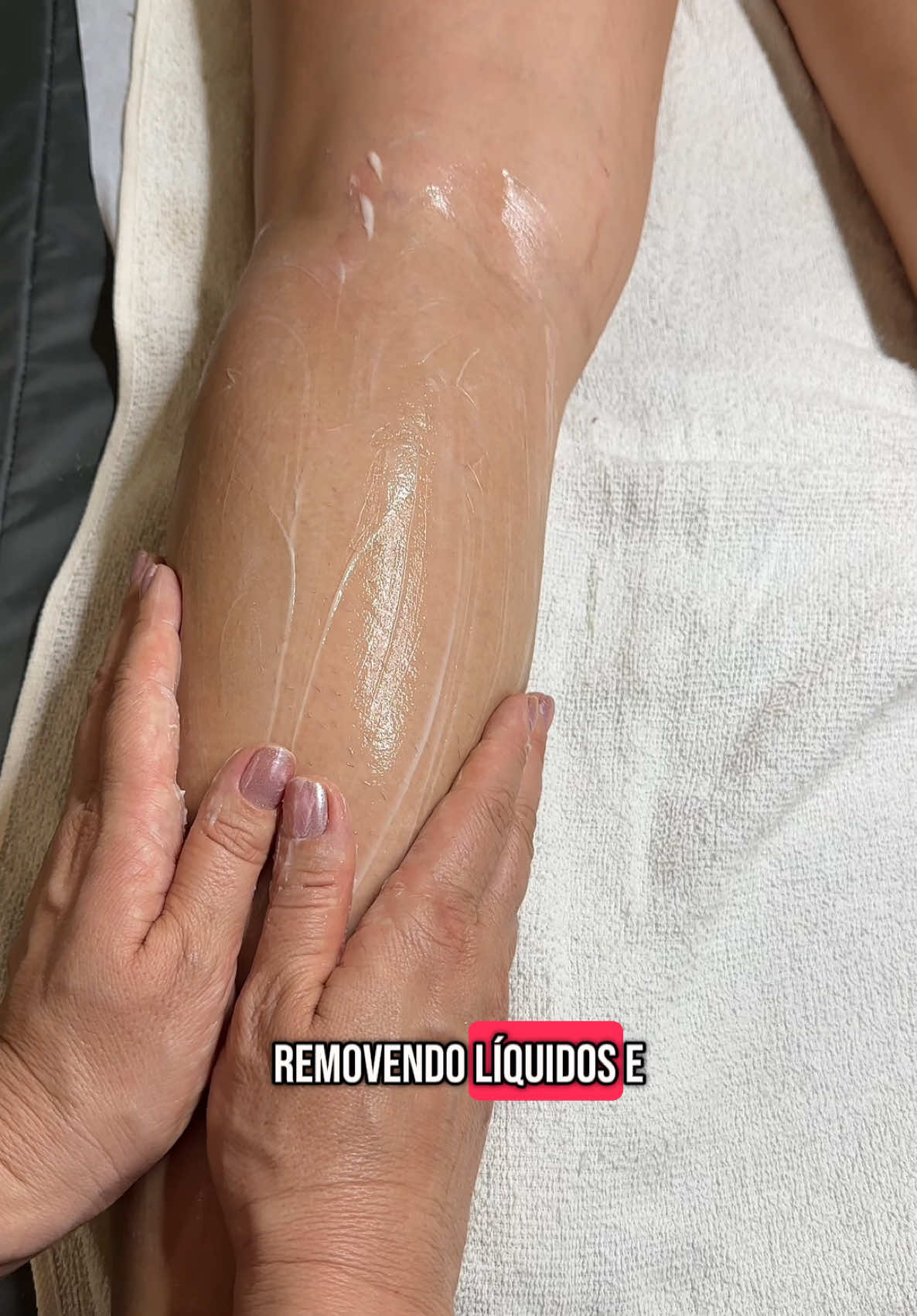 Drenagem linfática+ Lipedema #dermrio #estetica #esteticista #esteticacorporal #lipedema #drenagem
