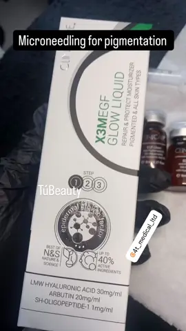 Microneedling for pigmentation using medical grade sterile premixed viles.  #facial #microneedling #collagen #antiaging #beauty #advancedskintherapist #skinspecialist #rejuvenate #pigmentation #malasma #sundamage 