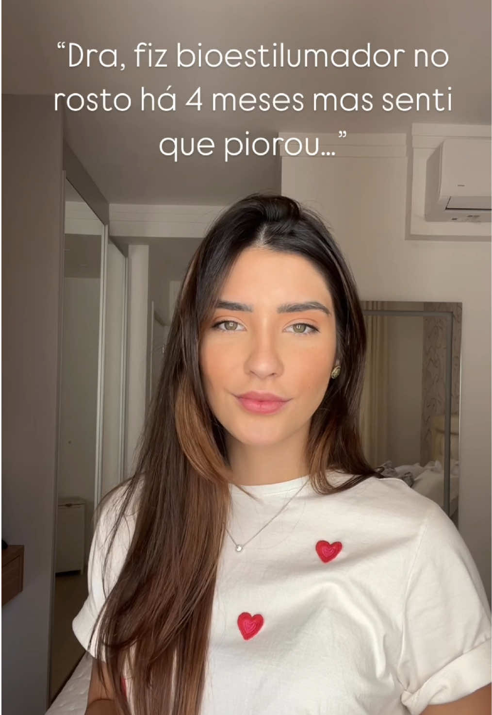 Sculptra no rosto pode pesar ainda mais! Se você tem o rosto mais cheinho, cuidado!  Esse bioestimulador estimula a produção de colágeno de forma difusa, deixando a pele mais grossa e pesada, o que pode aumentar o volume da derme, agravar a flacidez e pesa ainda mais a região do “buldogue” (aquele excesso de pele na lateral do queixo). Se a sua queixa é flacidez ou perda de contorno facial, existem outras opções de bioestimuladores mais seguras e eficazes! Obs: Se você tiver baixa porcentagem de gordura ou o rosto mais fininho, ele é uma ótima opção.  Já tinha ouvido falar nisso? Me conta aqui! 👇💬 #sculptra #flacidezfacial #bioestimuladoresdecolágeno #pele #dermatologia #fyp #foryoupage 