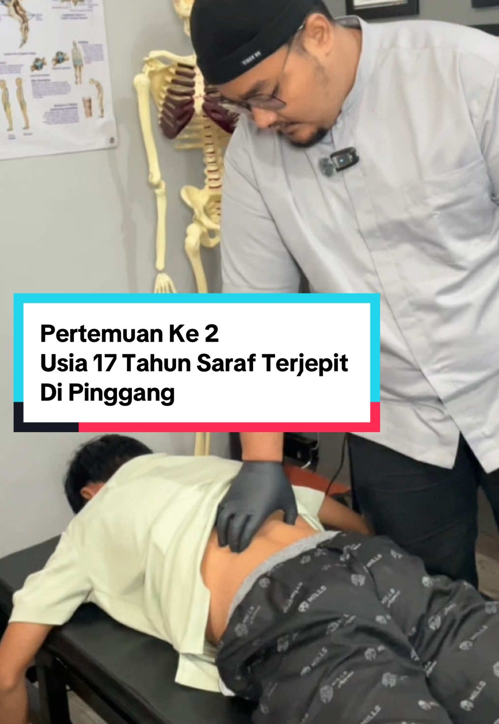 Pertemuan Ke 2, Usia 17 Tahun Saraf Terjepit Di Pinggang || Chat WA 081378710881 Untuk Reservasi, Konsultasi Atau Info Lebih Lanjut  #medan #Indonesia  #reposisi #Reposisibahu #dislocation #chiropractic #terapistroke #terapilistrik  #terapilistrikmedan #terapistrokemedan #kretekmedan #tittar #kretek #fyp #foryou #foryoupage  #tulangbelakang  #reposisitulang #sakitpinggang  #remajajompo  #kretekabalabal #boneadjustment #kusukmedan #kusuksyarafmedan #chiropracticmedan #hansboneandmucletherapy #Sayarafterjepit #asmr #kretekasmr #kriuk #sarafkejepit #sarafterjepit #kretekmedan#terapitulangbelakangmedan #terapisarafterjepit #terapiskoliosis #skoliosis #terapiskoliosismedan #terapisarafterjepitmedan #medanjohor #jcity #bonesettingmedan #frozenshoulder #hnp #terapistrokemedan #chiropractormedan #kretektulang #kretekmedanviral #ahlikretekmedan 