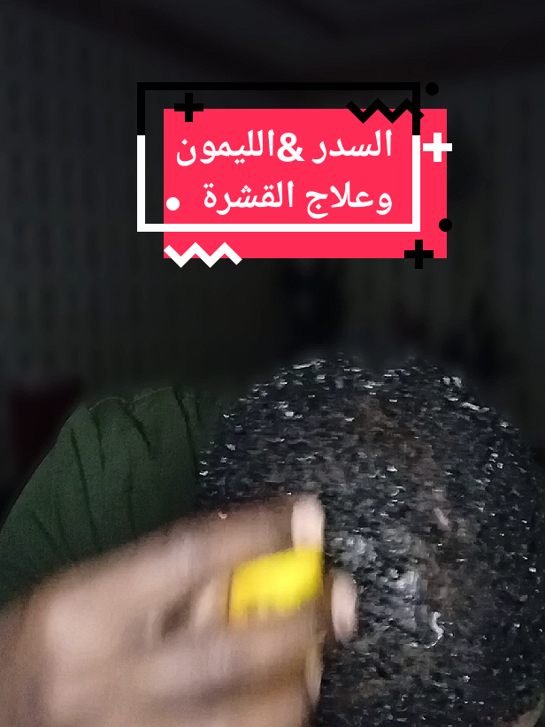 جربوا الوصفتين و وروني نتائجكم وصفة الليمون🍋 ممكن تعملوها مره الى مرتين في الأسبوع  وصفة السدر ممكن تعملوها يوم بعد يوم  أنا أحمد زايد صيدلاني التركيبات نقلت لكم تجربتي لعلاج القشرة وأنا كنت زيكم جربت العديد من الحلول والشامبوهات بعضها اداني نتائج لكن القشرة مابتختفي إلى إن توصلت لشامبو السدر الطبيعي   فعلا هو بنظف الفروة وبخلي الشعر صحي وعلى طبيعتو المهم بس لازم ترطبوا الشعر بعد استخدام السدر  ممكن بكريم التسريح اليومي الخاص بكم او باستخدام بلسم مغذي للشعر أما وصفة الليمون 🍋 أنا جربتها مؤخرا وبرضو ادتني نتائج مرضيه وقللت الحكه  وذلك لأن الليمون غني بفيتامين سي  اللي بشتغل كمطهر ومزيل للدهون #قشرة_الشعر #فيتامين #فيتامين_سي #السدر #dandruff #vitamin  @AHMED ZAID💊صيدلاني تركيبات @AHMED ZAID💊صيدلاني تركيبات 