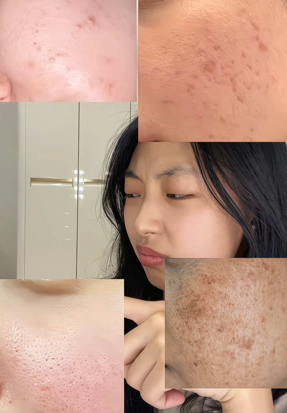 កុំប្រើskin1004 tone brightening ampoule(ពណ៌ស) ទៀត😱❌#skin1004 #serum #skincare #cambodia🇰🇭 #review #glowglamcosmetic 