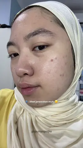 udah product ke dua, ya kali ga bagus?😝 #fyp #moisturizer #skintific #pinkmoisturizer 