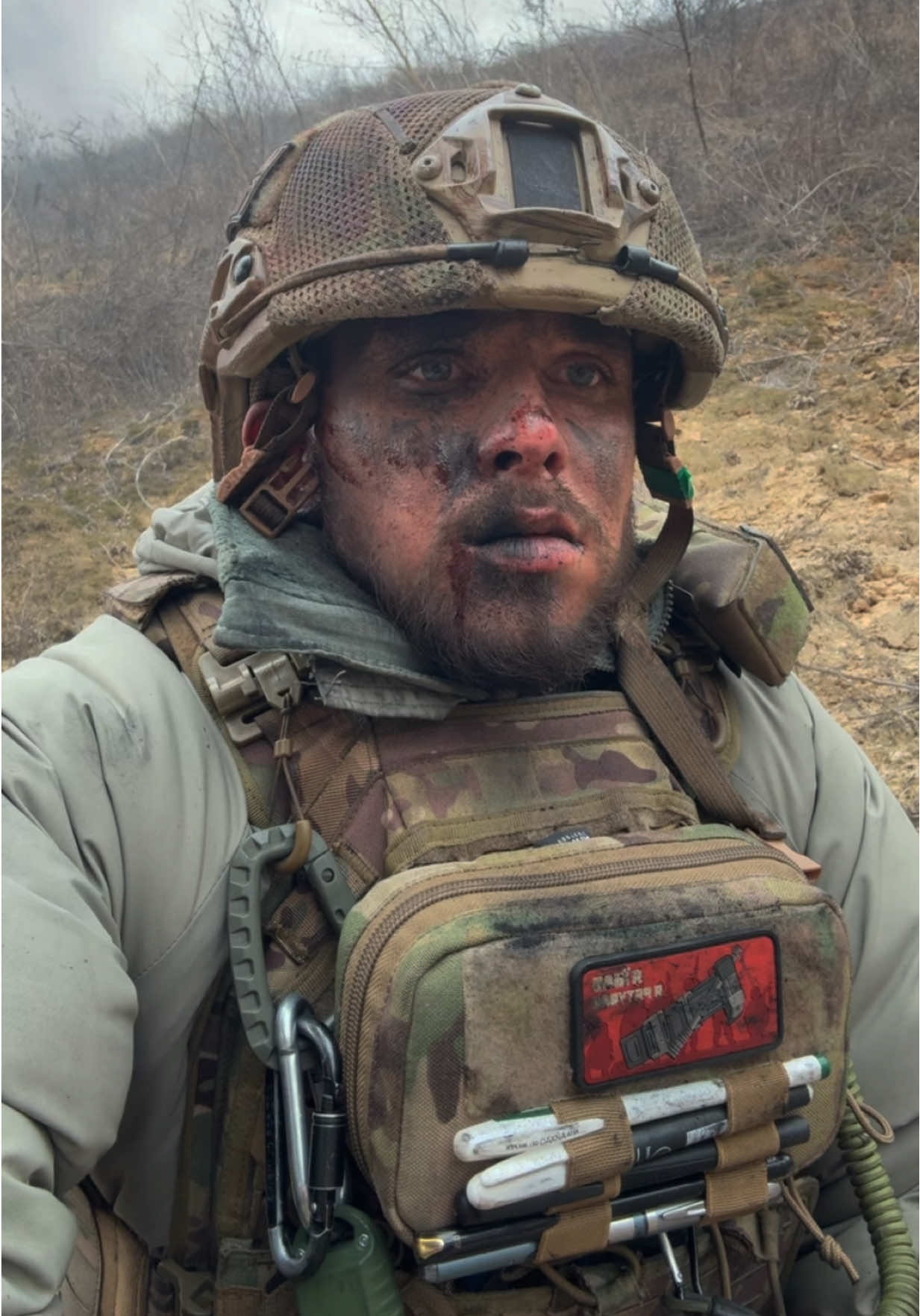 @Віцик - борець за життя 🇺🇦 все набагато гірше, ніж ви бачите … #зсу #славанації #віцик #віцикборецьзажиття #vitsikkkk 