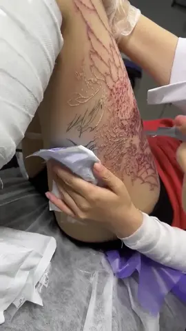 Remove tattoos without scars #tattoos#artist#tattooideas#foryoupage