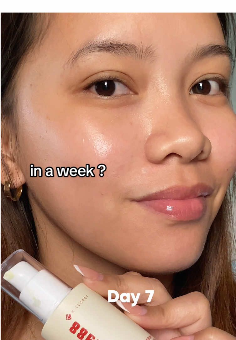 here’s a no filter improvement on my skin after using this retinal serum. truly a lifesaver 🥹 #skincare #skintok #kbeauty #koreanskincare #skincareroutine #7days #retinalserum #acneserum #poreserum #rednessserum #acnefree #clearskin #viralskincare #skincaretips #serum #pores #acne #retinol #retinal #fyp 