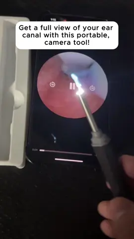 Ear cleaning made easy and high-tech! #earwax #earwaxremoval #satisfyingvideo