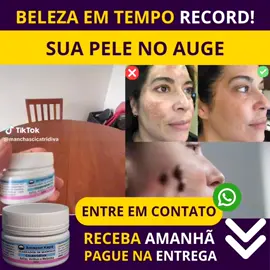 ✨ O Cicatridiva não é apenas um clareador, é uma solução definitiva para quem sofre com melasma, manchas escuras, acne e marcas indesejadas. Com uma fórmula 100% natural e cientificamente comprovada, ele clareia, regenera e hidrata profundamente , deixando sua pele mais jovem e saudável! Conheça CICATRIDIVA CLAREADOR. CLIQUE NO LINK DA BIO 🔗  . . . . #esfoliante #clareamento #clareadordemanchas #clareador #cicatridiva #manaus #manausnotiktok #pele #hidratação #virilhatotalmétodomartabatista #axilas #rosto #foryoupage❤️❤️ #viral_video 