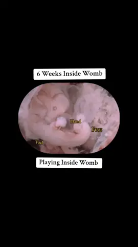 6 weeks inside womb | playing inside Womb #6weekspregnant #4weeksinsidewomb #babyinsidemomsbelly #babyinsidemytummy #babyinsidebelly #babymovinginbelly #babybelly #viralvideo #viraltiktok 