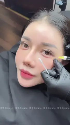 😒 Thay vì ngồi kẻ vẻ để tạo đôi mắt to tròn và tươi thì sao ce k chọn biện pháp tiêm bọng mắt cười Hàn Quốc nhỉ 𝐓𝐢𝐞̂𝐦 𝐛𝐨̣𝐧𝐠 𝐦𝐚̆́𝐭 𝐜𝐮̛𝐨̛̀𝐢 đang cực kì hót và trẻ baby luôn nha mn ưiiii  👉🏻 #Tiêmbọngmắtcười giúp đôi mắt trở nên ngây thơ long lanh , khuôn mặt trở nên trẻ trung , baby và giúp đôi mắt to tròn hơn đó ạ 😘  💌 Inb cho em để dc tư vấn nhaa 💋#bongmatcuoi #Tiêmfiller #fillerbottoxchuanykhoa #TiêmFillerAnToàn 