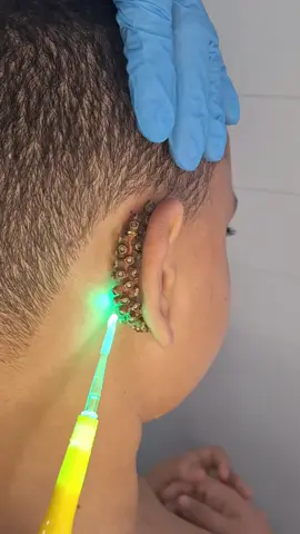 Ce petit garçon était désespéré et pleurait tous les jours, car il avait quelque chose collé derrière l’oreille. Mais ce que les médecins ont découvert était si incroyable.  #histoire #histoirevraie #apprendresurtiktok