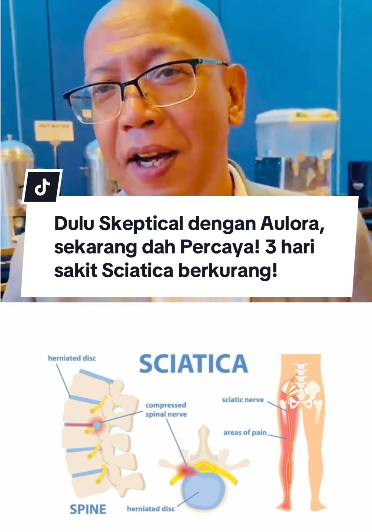 Testimoni sharing - Abang Azmi pada mulanya skeptical dengan Aulora. Tapi isteri beliau hadiahkan Aulora Boxer untuk ikthiar sakit Sciatica yang beliau hidapi selama hampir 1 bulan.  Amazingly, selepas 3 hari memakainya secara konsisten,  beliau sudah mula terima manfaat dari Aulora Boxer! #AuloraBoxer #AuloraPants #HealingJourney Jom dengar kisah beliau!  Siapa ada family member yang ada masalah sama, mohon panjangkan video ni dengan tekan button share okay! 🥰 Nak tahu more info abt Aulora!  Boleh ws Anna 018-3580258 📲 #auloraseries #auloraserieswithkodenshi  #auloraseamlessbra  #auloraseamlessbrakodenshi #aulora #aulorapants  #auloraarmsleeve #aulorascarf #aulorasocks #auloraseries #farinfrared #healthbenefits #beinternationalmalaysia #creatorsearchinsights