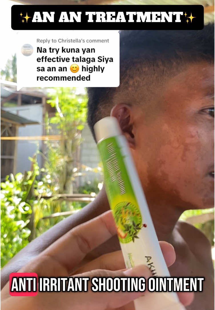 Replying to @Christella yes super legit and effective talaga kaya naman hindi nakakahiyang e recommend ito sa mga taong matagal na nag struggle sa ganitong skin disease😍#akiika #antiirritantsoothingointment #anansolution #anantreatment #skinproblemsolution 