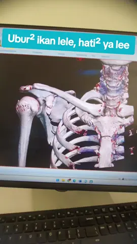 #fyppppppppppppppppppppppp #radiographer #nakes 