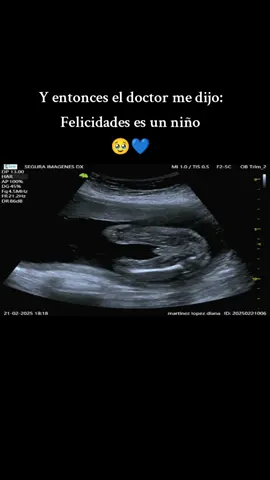 Y es que mi corazón siempre  lo supo💙🥹🐣 mi pollito #mamaprimeriza #babyboy #22semanas #teamjunio @😉♡♡tu   chinito●♡ 