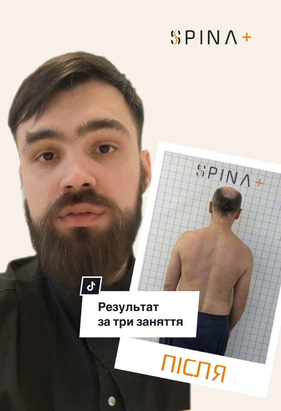 Всього три заняття – а результат уже є! ✨ А що далі? Займаємось над покращенням стану та постави! Приходьте на консультацію та відчуйте дію кінезітерапії на собі 😉