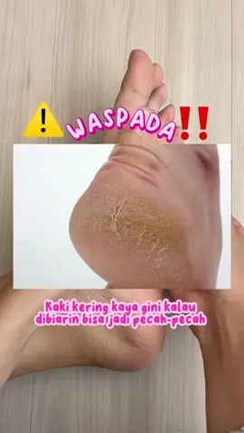 WASPADA KAKI KERING KAYA GINI KALAU DIBIARIN BISA JADI PECAH-PECAH! Kalau kaki bestie udah kaya gitu, mending langsung dirawat aja pakai Azalea Smooth Foot Cream karena kandungan Zaitun Oil dan Honey cocok untuk masalah kaki kering, kapalan dan pecah-pecah  #AzaleaBeautyHijab  #AzaleaCantiknyaMuslimah  #AzaleaSmoothFootCream  #BikinMoodJadiGood  #BestieHijabers  #Hijabers 
