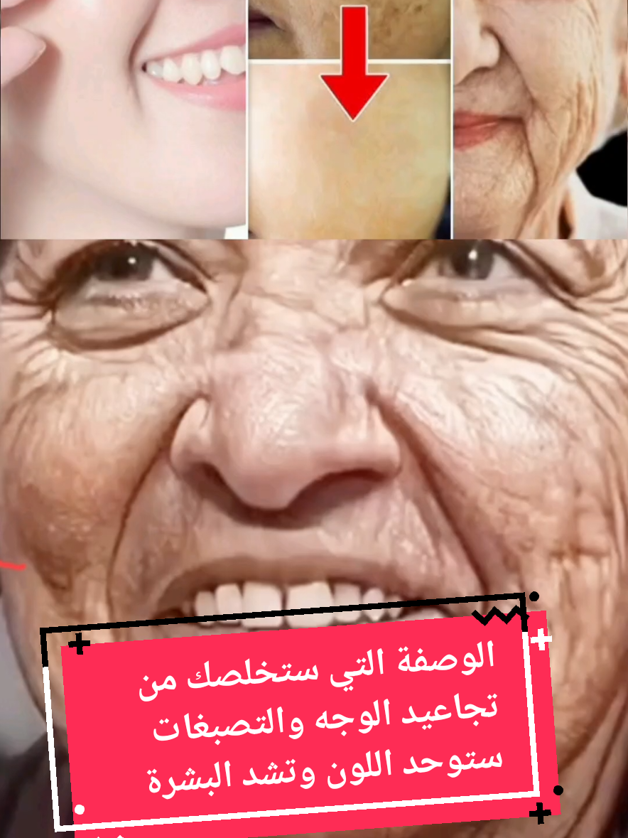 احصلي على بشرة مشدودة خالية من التجاعيد والتصبغات بوصفة قوية فعالة  #وصفة #وصفات_طبيعية #تفتيح_البشرة #تفتيح_فوري_للبشرة #تبييض_بشرة #تبييض_الوجه #تجاعيد_الوجه #تجاعيد_الشيخوخه #شيخوخة_البشرة #شيخوخة_مبكرة #تصبغات_الوجه #تصبغات_البشره #بشرة_مشدودة #بشرة_صافية #بشرة_نضرة #توحيد_لون_البشره #