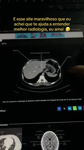 #medicina #studytok #estudantedemedicina #dicasdemedicina #medstudent 