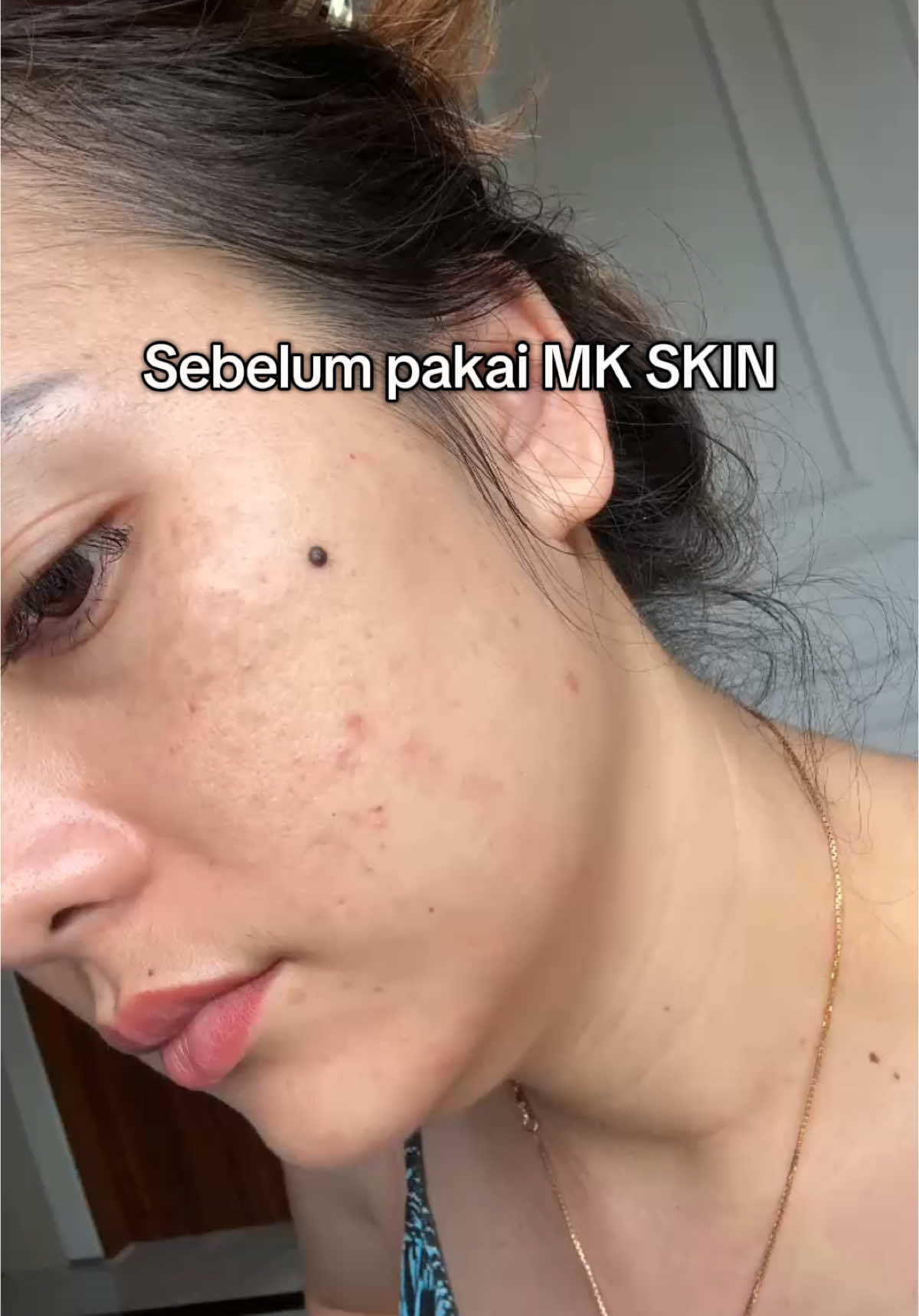 Real testi tanpa treatment apapun🫣 #maharanikemala #mkskin #mkskin #skincare 