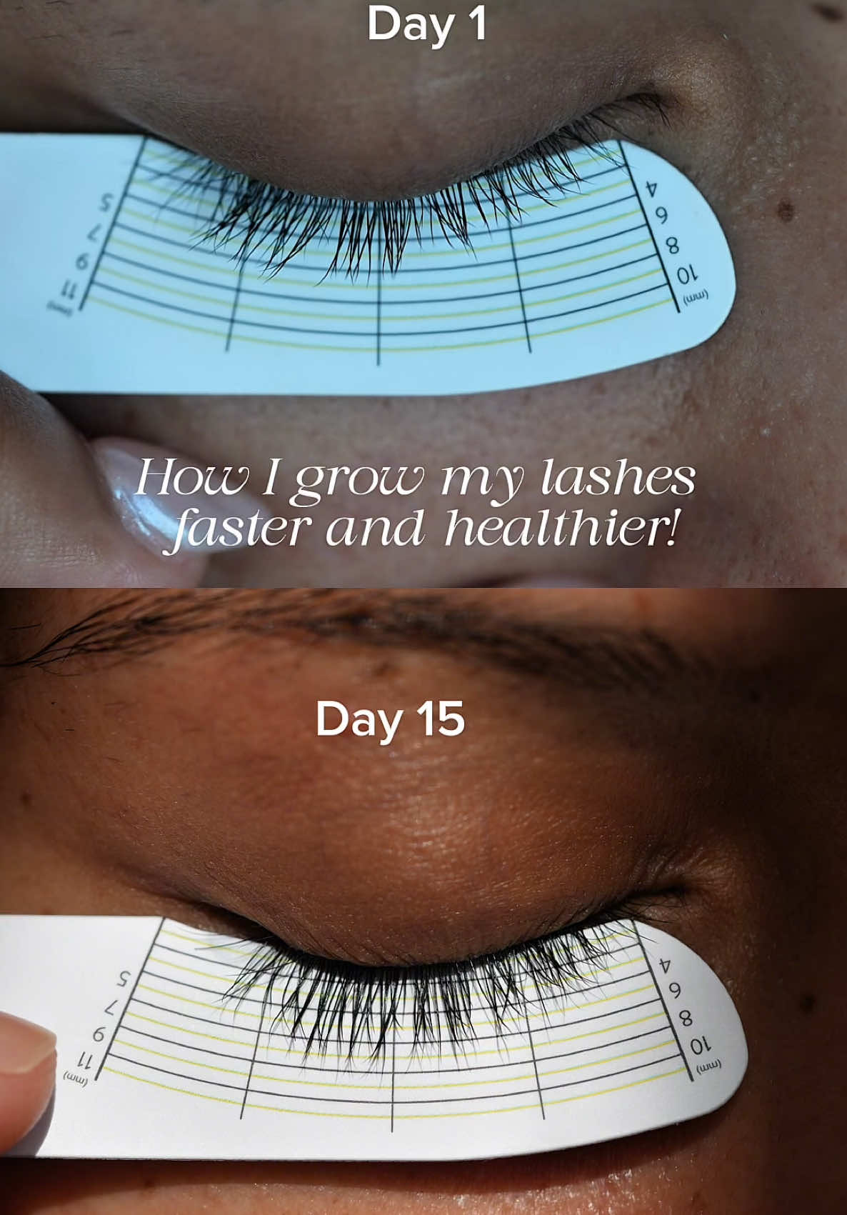 15 days in… and my lashes are thriving! 😍 @bentoncosmetic Honest eyelash Serum ✨ Less breakage ✨ Less lash fall ✨ Stronger, healthier lashes Consistency is key, and I can’t wait to see even more growth! 🤩 You can find it on Amazon or check the link in my bio! 💖 Who else is on a lash serum journey?  #benton #bentoncosmetic #lashserum #lashes #lashgrowth #lashcare #eyelashestutorial #kbeauty #bentoneyelashserum #eyelashserum #eyelashes #koreanskincare #lashconditioner #naturallashes #lashlift #amazonbeauty #beautyhacks 