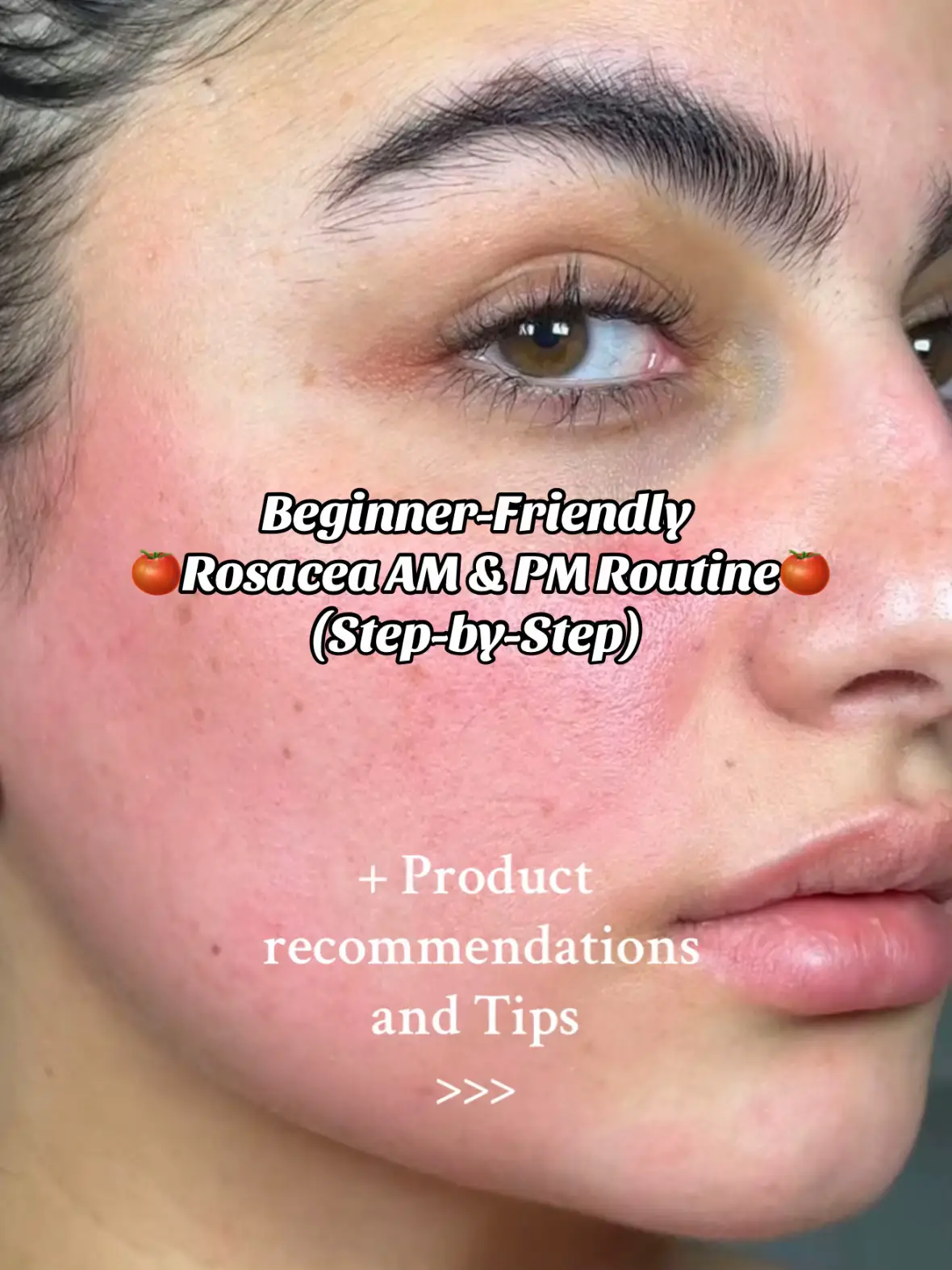 Most of the products are l*nked in my storefront!You can find the full product list in the pinned comment under the same post on Instagram.  #rosacea #rosaceaskincare #rosaceacheck #rosaceaawareness #rosaceatreatment #redness #skincareroutines 