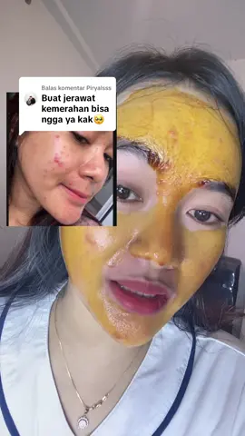 Membalas @Piryalsss bisa kaka aku tinggal bekasnya aja sekarang