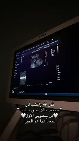 ماشاءالله تبارك الله🤍#اكسبلورexplore #طلعوني_اکسبلور #هاشتاقات_تيك_توك_العرب #ترند_تيك_توك #تيك_توك #ترند #ترندات #حفرالباطن #هاشتاق #ماشاءالله #الشعب_الصيني_ماله_حل😂😂 #حفرالباطن_الان #مالي_خلق_احط_هاشتاقات #اللهم_صلي_على_نبينا_محمد #الله_يحفظك #اغنيه_تيك_توك #اغنيه #اغنيه_ترند_الجديد #اغنيه_ترند #مستشفى_الولاده #سونار #سونار_الحمل #طفل #طفلي #طفلتي #بيبي 