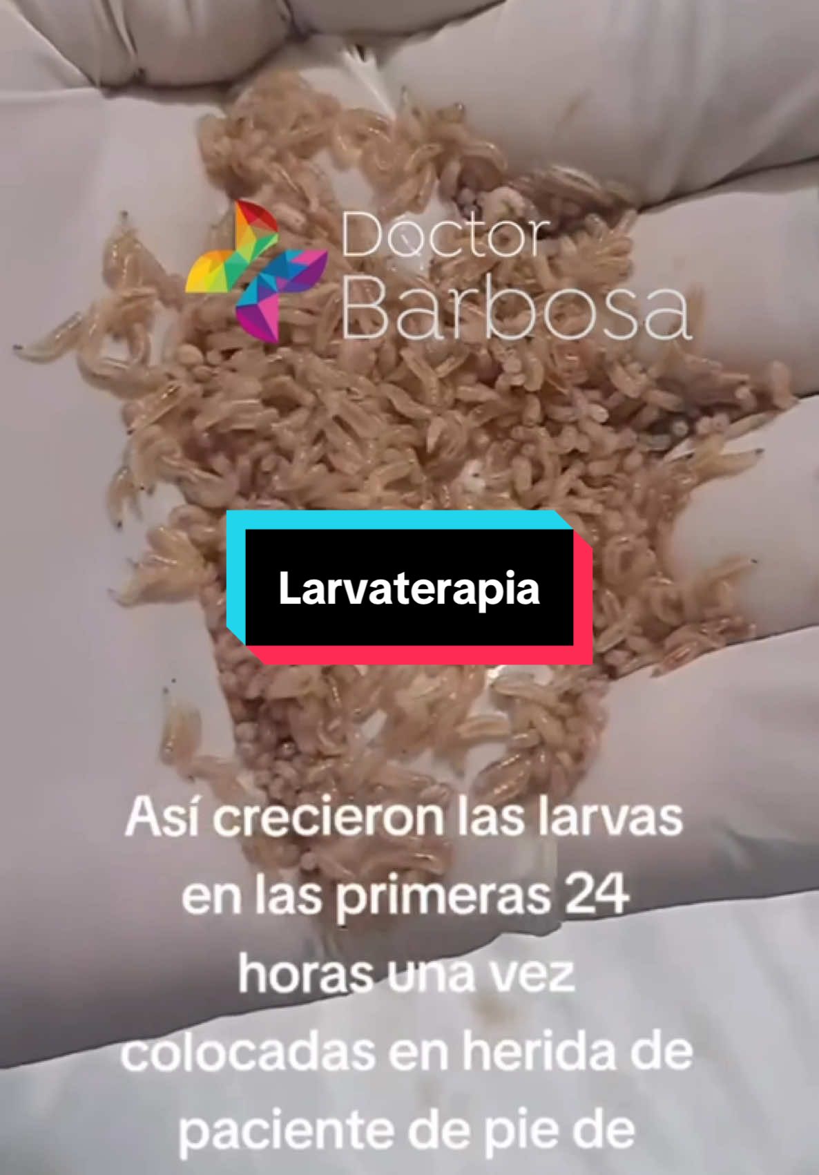 ¿LARVAS DE MOSCA? 🪰 #paratii #diabetes #larva #mosca #heridas #medicina 