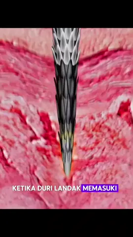 Bagian 3 | Ini yang terjadi aaat duri landak menusuk bagian kulitmu Sumber : @Zack D. Films  #faktarandom #menarikbukan? #faktaunik 