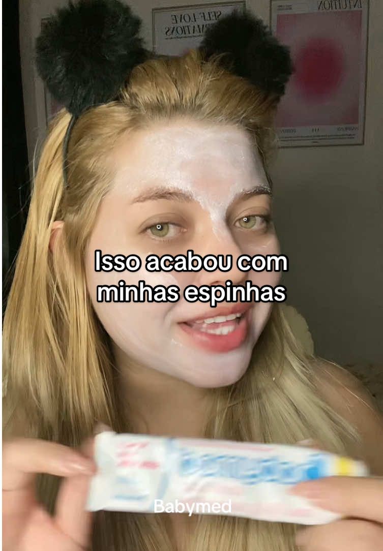 Essa pomada acabou com as minhas espinhas e manchas do meu rosto  #espinhas 