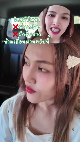 ทุกวันนี้เราพูดเรายิ้มได้อย่างมั่นใจขึ้นมาก 🦷🪥 #EliteSmile 