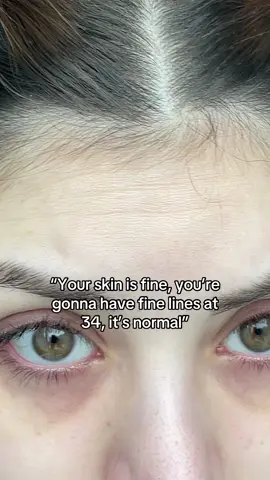 No thanks no wrinkles for me #wrinkles #skincare #koreanskincare 