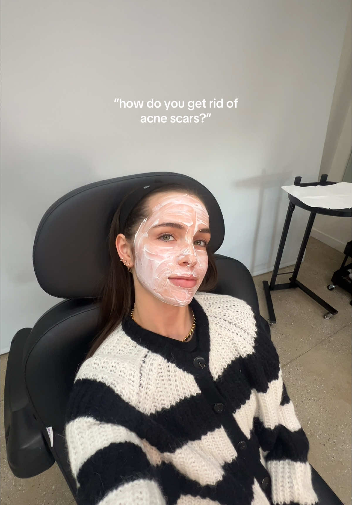 flawless skin loading… @Cyma, NP • NYC Botox & Filler @Velour Medical #microneedlingface #microneedlingtherapy #acnescars #acne #acnetreatments #acne #scars #darkspots #collogen #facial #acnescartreatment 