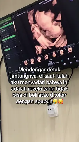 #masyaallahtabarakaallah #allahumabarik #bumil #usg #trimester3