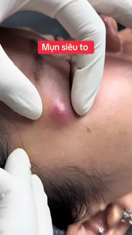 Xem hêt clip nha mn , #mun #lisabeauty #spabinhthanh 