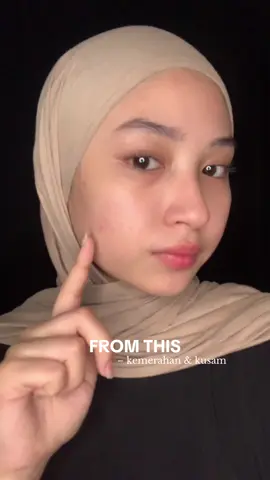 facewash sebagus ini cuma 30k an aja🤩#acnebestie #acnaway @Acnaway Official 