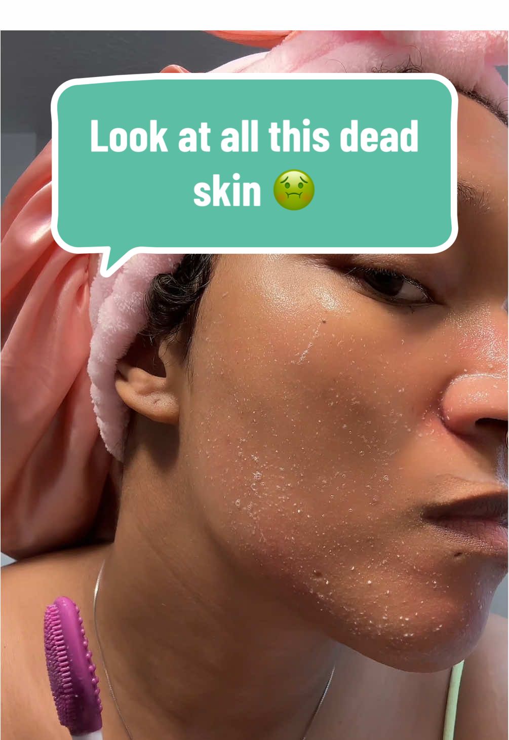 Dr. Melaxin Peel Shot black and white rice duo is skincare you can use AT HOME EVERY 👏🏽 SINGLE 👏🏽 DAY! #drmelaxin #peelshot #exfoliating #niacinamideskincare #brighteningpeel #dullskin #deadskin #hyperpigmentation #skincareathome #beautifulskin #koreanskincare 