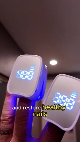 Tired of hiding your nails in public? Tried every natural remedy out there? Tea tree oil… Garlic… Vinegar baths… Nothing works. It’s time for real science—not home remedies. Introducing Lumi Nail Care™️ , an advanced blue & red light therapy system designed to penetrate the nail plate and eliminate fungus at its source. No more false promises. Just clean, healthy nails—backed by science. 🚨 Selling out fast—don’t miss your chance! 🚨 