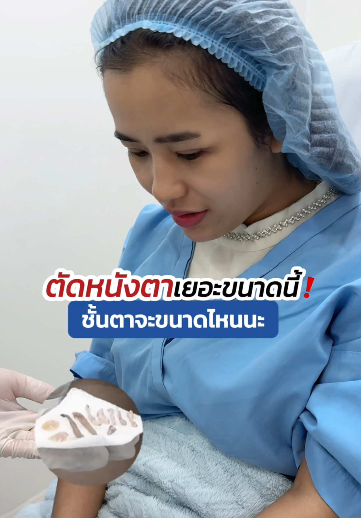 ตัดหนังตาเยอะขนาดนี้ ชั้นตาจะออกมายัง ‼️ #หมอสกาย #จักษุแพทย์ #skyclinic #ทำตาที่ไหนดี #ศัลยกรรมตา #สกายคลินิก #หนังตาตก #รีวิวตาสองชั้น #รีวิวบิวตี้ 