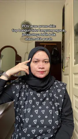 kegiatan wajib tiap bangun tidur #acnefighter #pejuangjerawat #acnefighter #fypage #xybca 