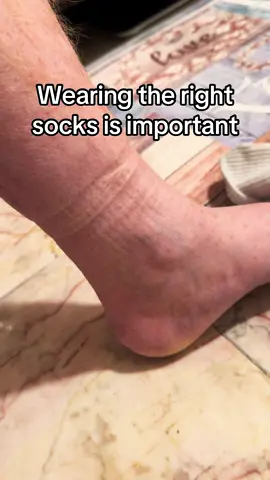 #diabeticsocks #diabeticlife #diabetesawareness #socks #compressionsocks #healthylifestyle #wellness #SelfCare #Fitness #health #nutrition 