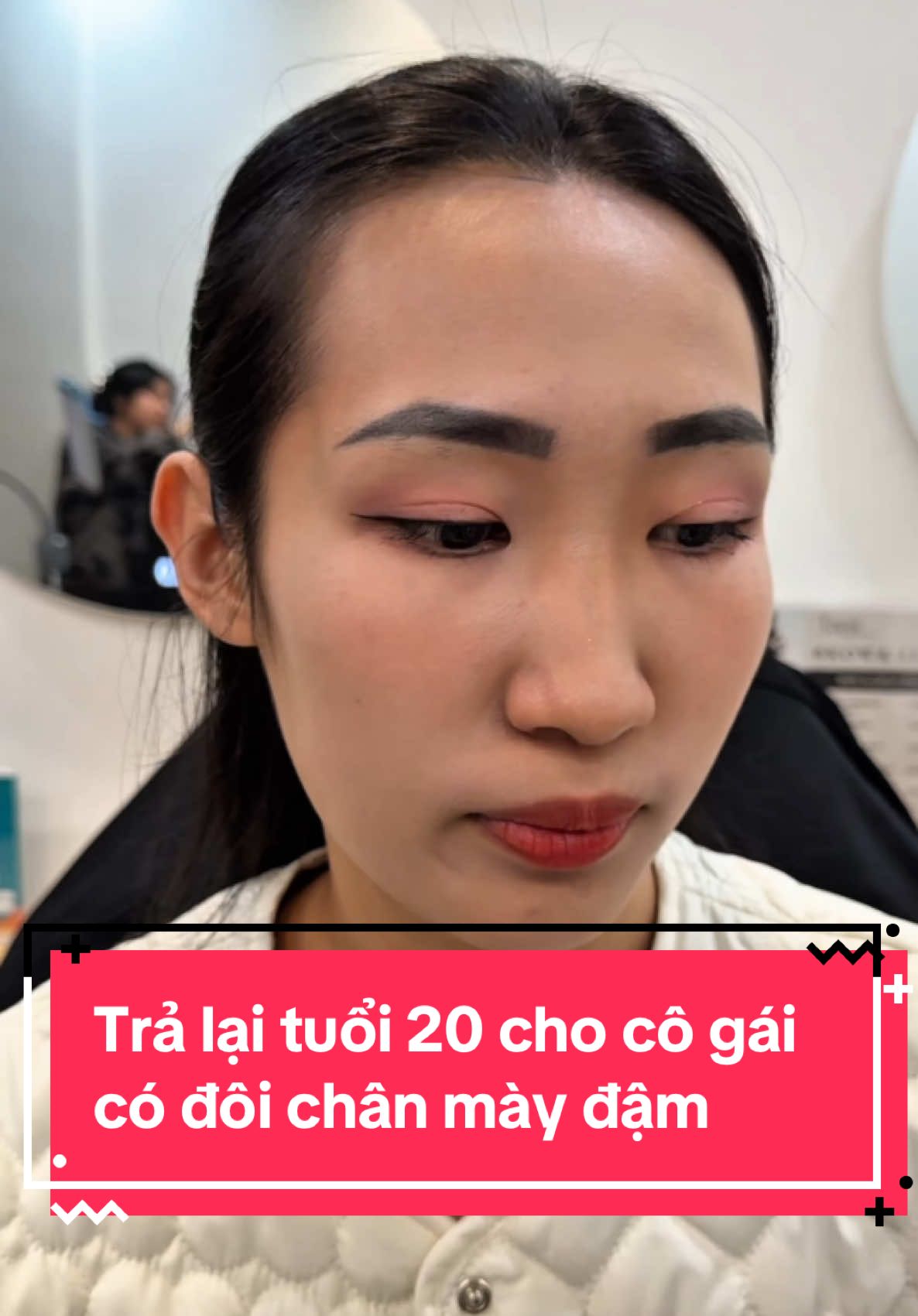 Trả lại cho em ngày tháng 20 tuổi xinh đẹp, xoá lông mày cũ trẻ ra hẳn các bác ạ #xuhuong #xoaxam #xoaxamlongmay #xoaxamchanmay  #xoaxamkhongseo 