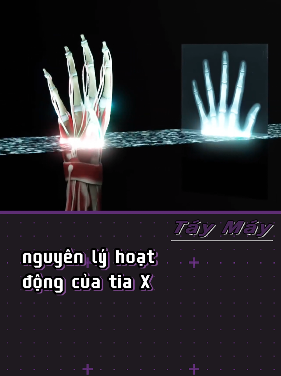 máy phát tia X#xuhuong #tiktokviral #khoahoc #giaitri 
