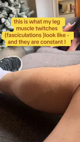 #fasciculations #spasm #muscular #disability #mnd #als #motorneuronedisease #muscle #fyp 