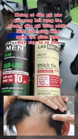 MenHairLoss: oke Thick Fix: nâng cấp hơn Men Hairloss  #viral #fyp 