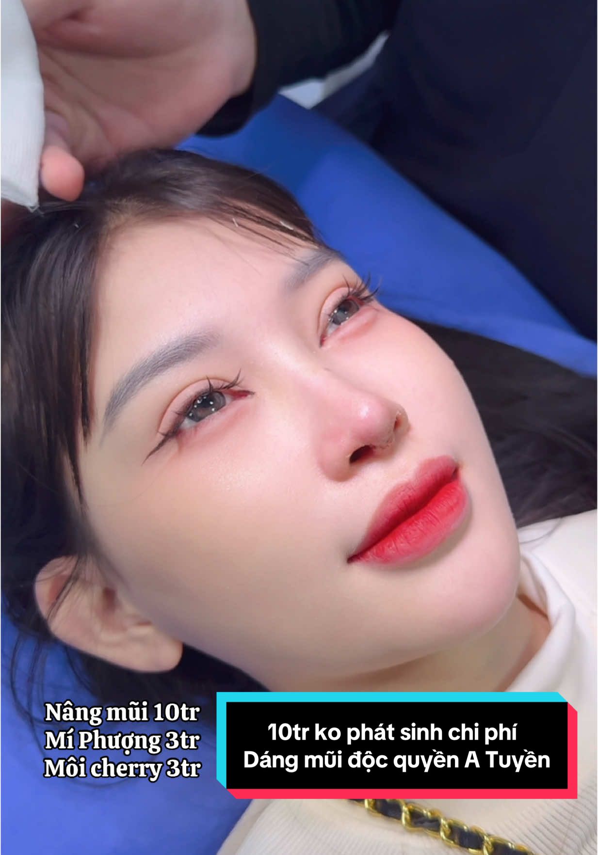 Trả lời @mẹ đơn thân mũi 10tr có phát sinh thêm chi phí gì không anh #xuhuong #LearnOnTikTok #nangmui #nangmuiphongthuy #nangmuisline #nangmuicautruc 