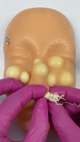 Turning a beautiful face into a pimple-covered one in an instant. satisfying relax asmr #siliconemodel #capcut #howtomakepimples #acnetreatment #asmrtiktoks #asmr #viralvideo #fypシ #pimple #pimplepopping #pimple_popper_asmr #tingles #asmrtingles #asmrtriggers #artificialskin #education #oddlysatisfying #relaxingcontent #skincaretips #asmrsounds #usa #mochipimplepopping #bonniepimplepopperasmr 