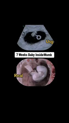 7 Weeks baby Inside Womb vs Ultrasound #pregnant🤰 #pregnanttiktok #pregnanttiktok #babyinsidewomb❤️ #pregnantlife #babyinsidemytummy #pregnancyjourney #babyinsidebelly #7weeks #7weeksand3days #7weekspregnant #viralvideo #viraltiktok 