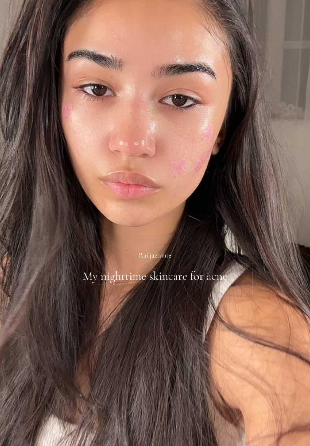 Goodnight 🐒 #skincare #beauty #fyp #NighttimeSkincare #AcneProneSkin #ClearSkinJourney #SkincareRoutine #AcneFighting #GlowUp #HealthySkin #SkinCareTips #AcneSolutions #SkincareForAcne #SkincareCommunity #NightTimeRoutine #AcneTreatment #ClearSkinGoals #BeautyRoutine #SkincareForAll #AcneCare #CleanSkin #SensitiveSkinCare